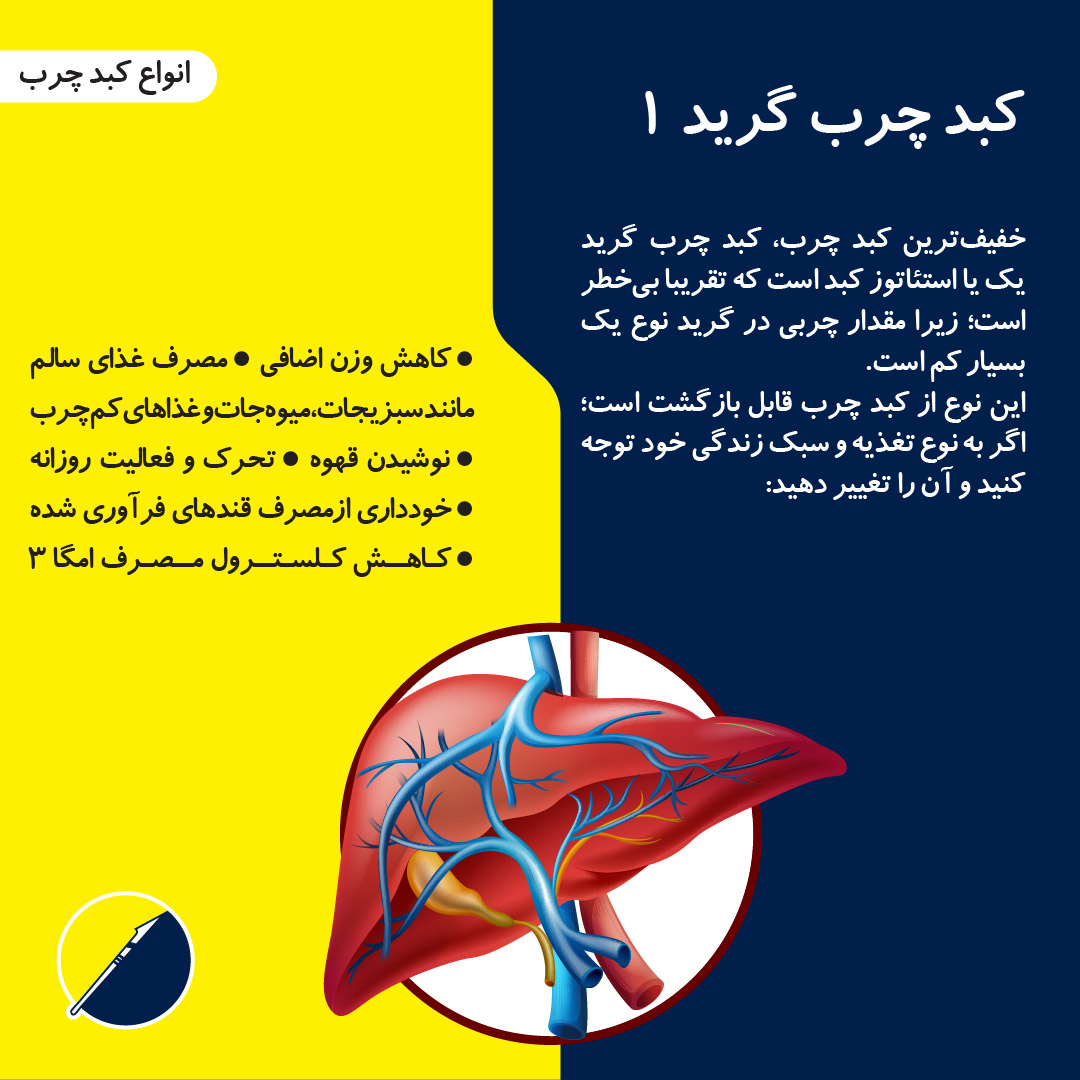 معرفی انواع کبد چرب