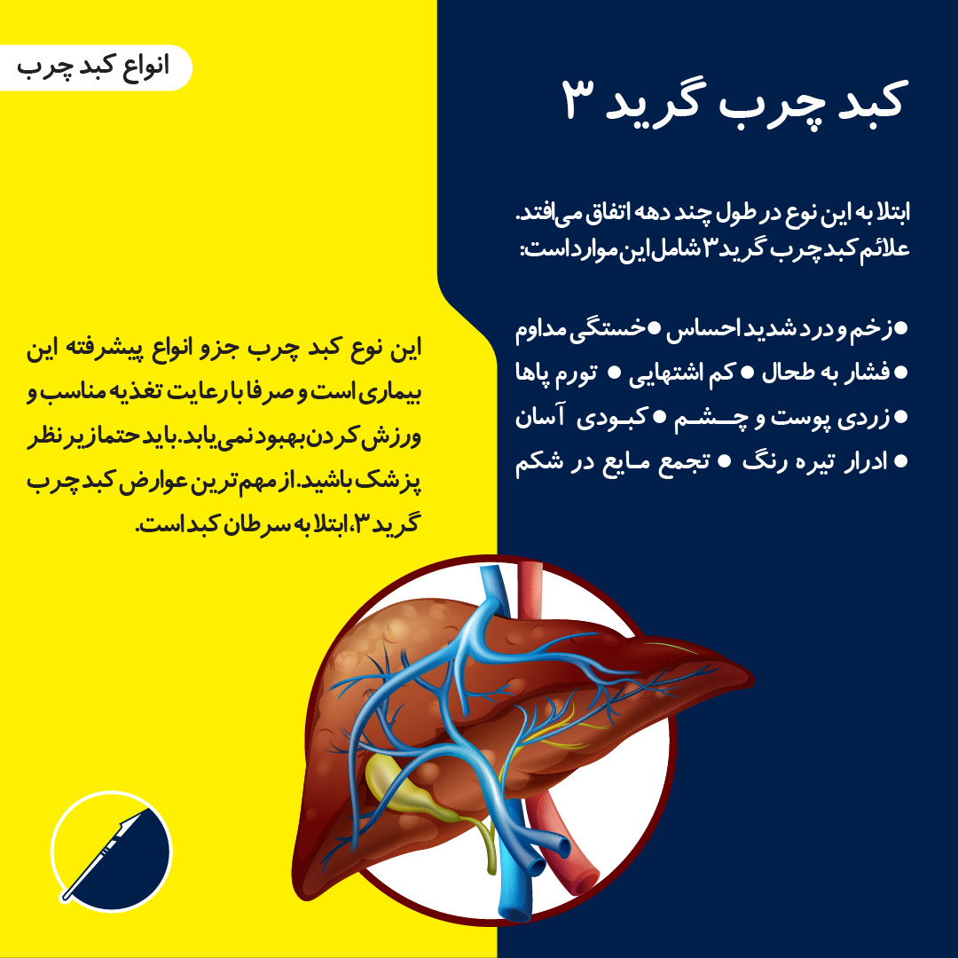 معرفی انواع کبد چرب