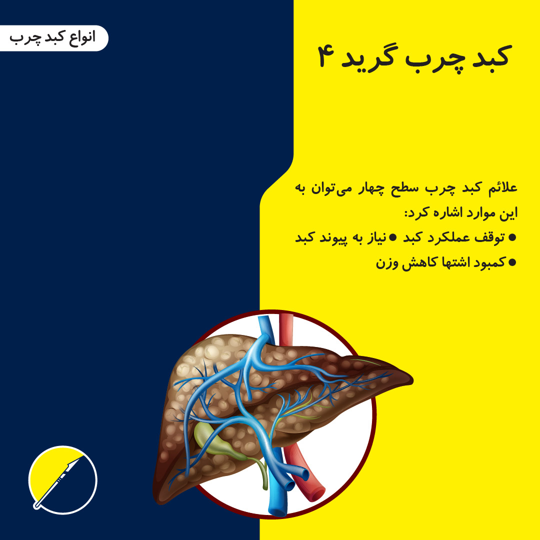 معرفی انواع کبد چرب