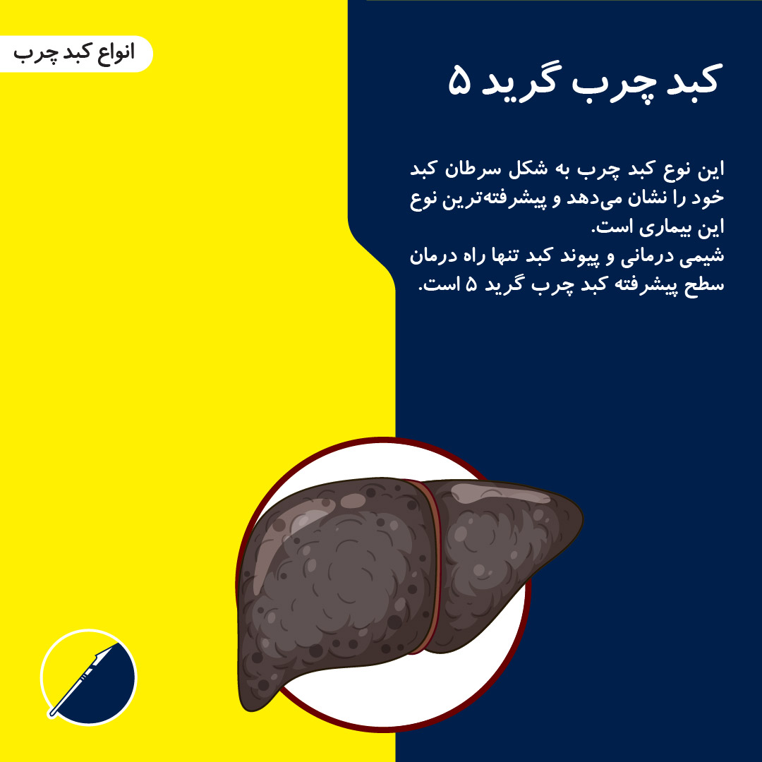 معرفی انواع کبد چرب