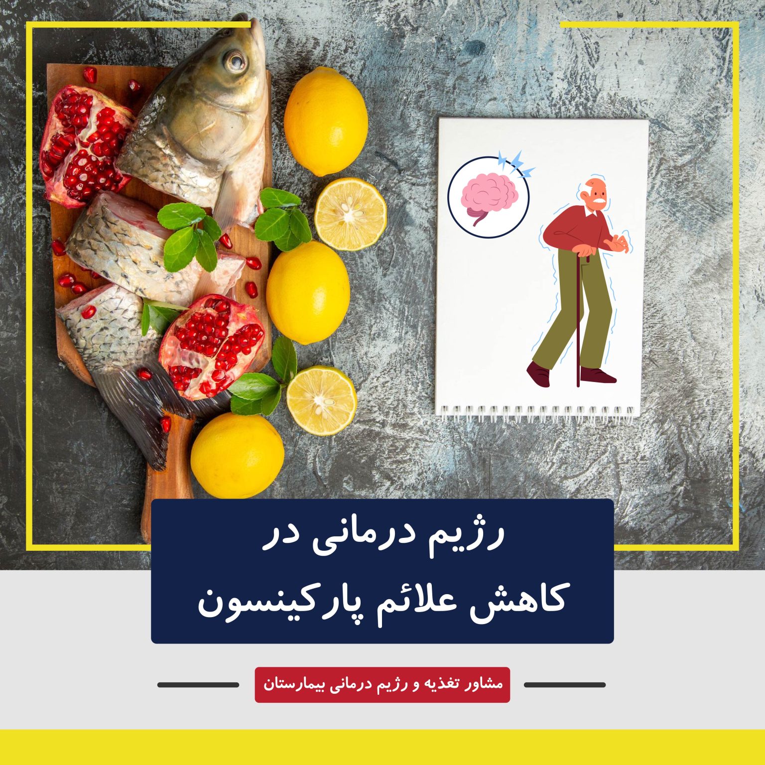پارکینسون